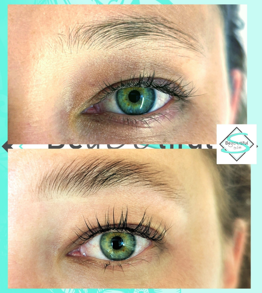 vorher-nachher-franz